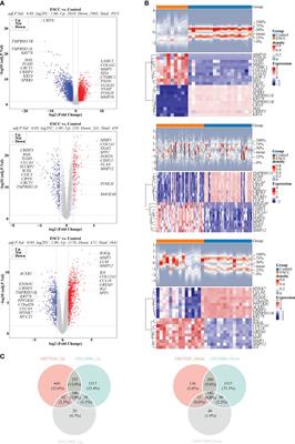 Immune cell related signature predicts prognosis in esophageal squamous cell carcinoma based on single-cell and bulk-RNA sequencing